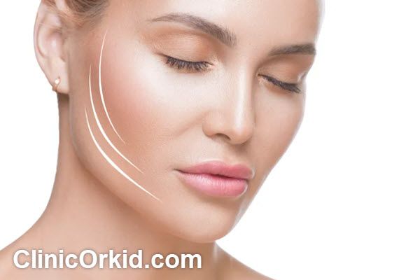 ویژگی های بهترین دکتر اندولیفت در غرب تهران | آکادمی رویا هرندی