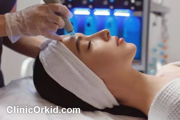 مزایای میکرودرم | کلینیک ارکید