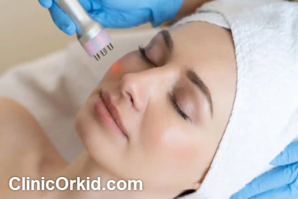 بهترین کلینیک اندولیفت در غرب تهران | کلینیک ارکید