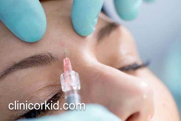 ماندگاری تزریق بوتاکس پیشانی | کلینیک ارکید
