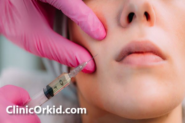 تزریق فیلر چیست؟ | کلینیک ارکید