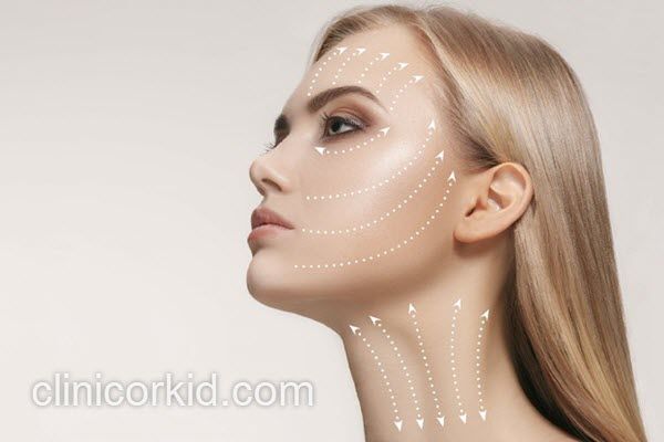 اندولیفت صورت با ماندگاری بالا | کلینیک ارکید