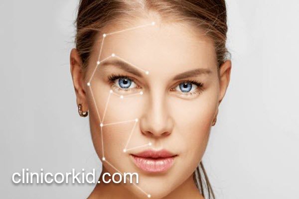 لیفت صورت با تکنیک اندولیفت | کلینیک ارکید