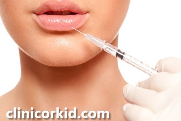 تزریق ژل لب چیست؟ | غرب تهران