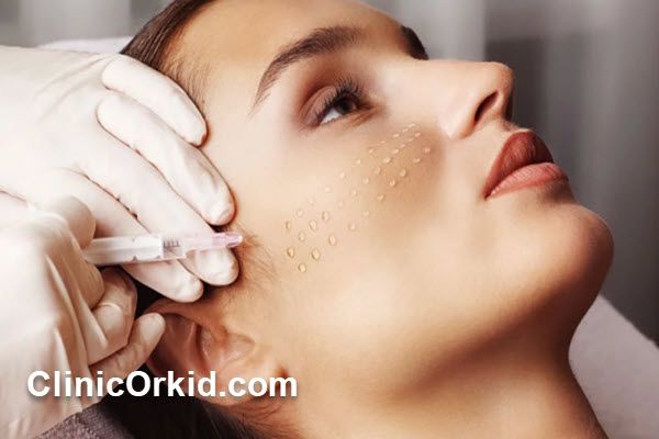 مراقبت های لازم بعد از مزوتراپی صورت چیست؟