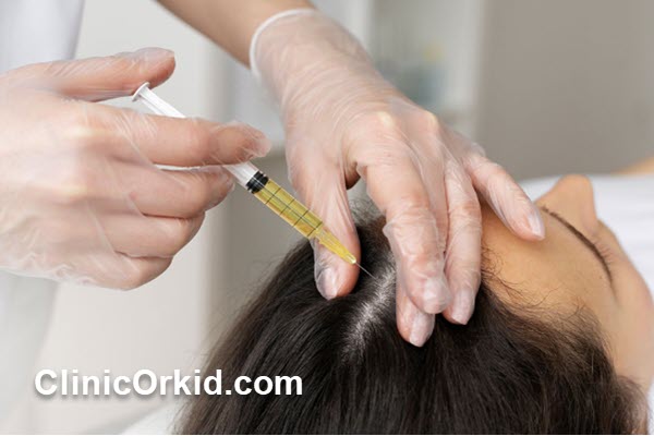 مزوتراپی مو چیست؟