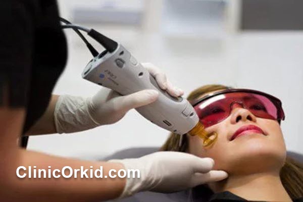 چرا لیزر الکساندرایت کندلا بهترین انتخاب برای رفع موهای زائد است؟