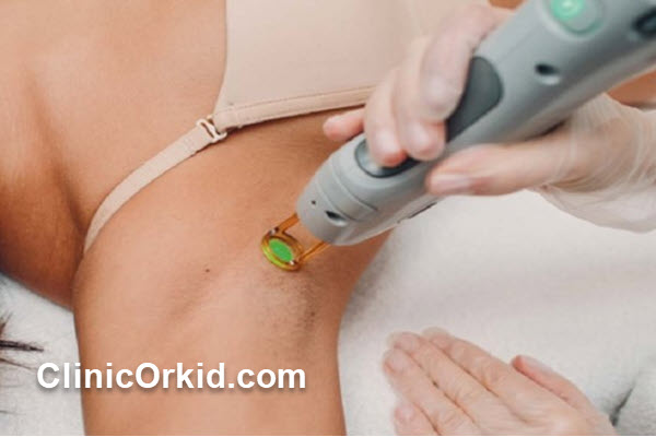 چرا انتخاب بهترین مرکز لیزر الکساندرایت کندلا اهمیت دارد؟