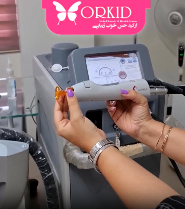 لیزر-الکس-کندلا-در-غرب-تهران-کلینیک-ارکید استفاده از لیزر الکساندرایت کندلا در غرب تهران | کلینیک ارکید