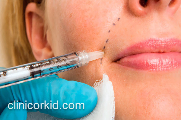 بهترین مرکز تزریق ژل در تهران | کلینیک ارکید