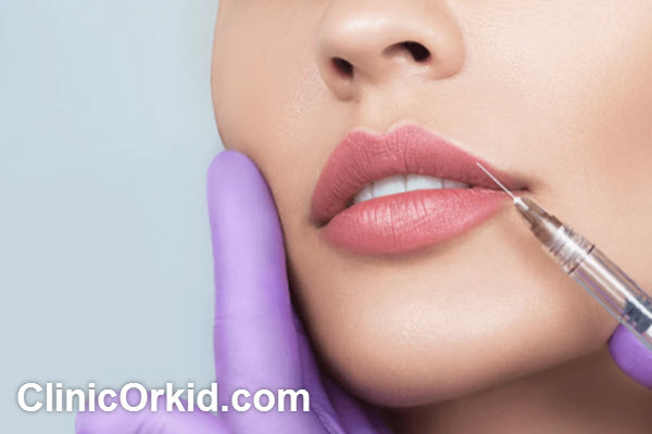 هزینه تزریق فیلر لب و عوامل موثر بر آن