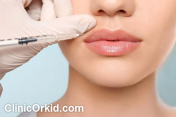هزینه تزریق ژل لب چقدر است؟