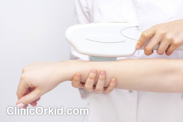 لیزر دست چند جلسه است؟