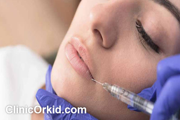 بهترین کلینیک تزریق فیلر لب در پونک