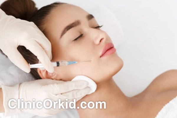 تزریق ژل خط خنده چیست؟
