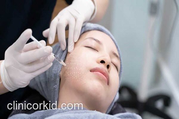 هزینه تزریق مزوتراپی صورت چقدر است؟