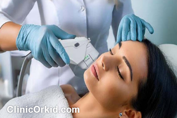 مراقبت های بعد از هایفوتراپی دور چشم