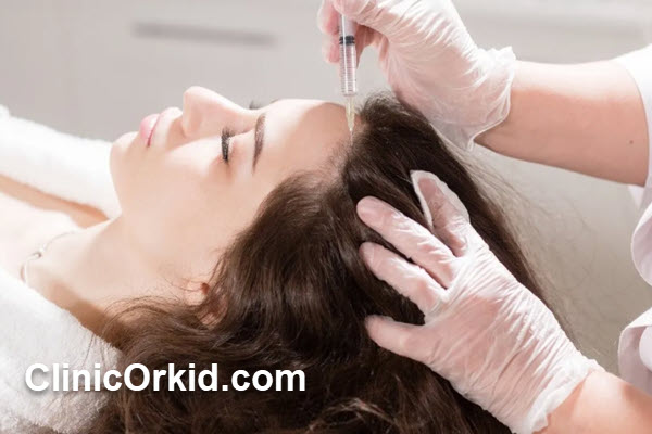 مراحل انجام مزوتراپی در کلینیک ارکید