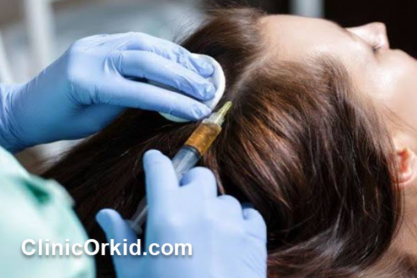 مزوتراپی مو چیست و چگونه به درمان ریزش مو کمک میکند؟