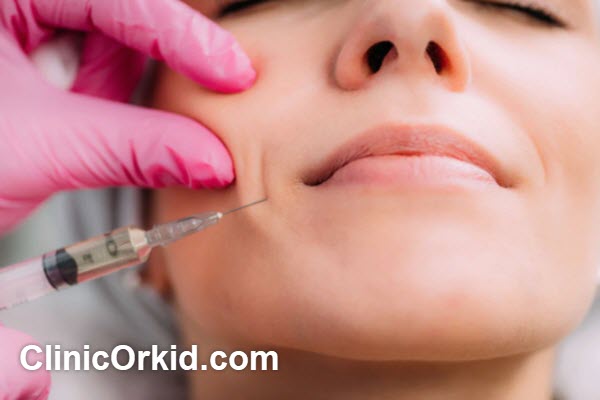 مرکز تزریق ژل خط خنده در پونک