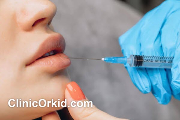 نقش پزشک در نتیجه تزریق ژل لب