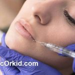 ماندگاری تزریق ژل لب چقدر است؟