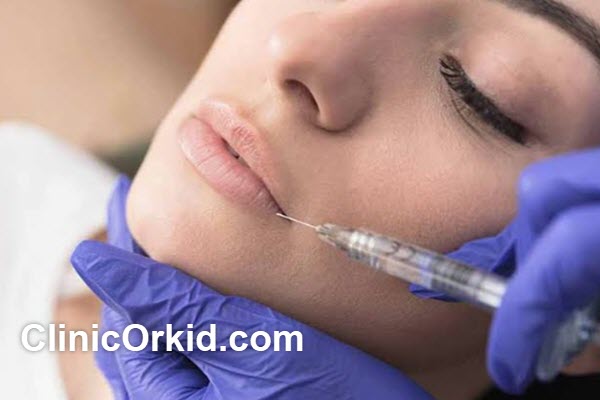 ماندگاری تزریق ژل لب چقدر است؟