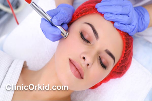 مزایای میکرودرمی و میکرونیدلینگ