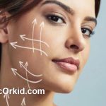 اندولیفت پوست بدون جراحی در پونک