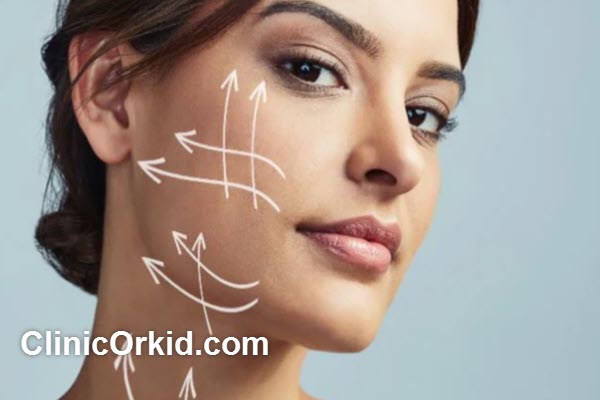 اندولیفت پوست بدون جراحی در پونک